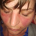 Profile Picture of Lupuson Wikipedia