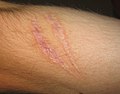 Profile Picture of Scar - Wikipediaon Wikipedia