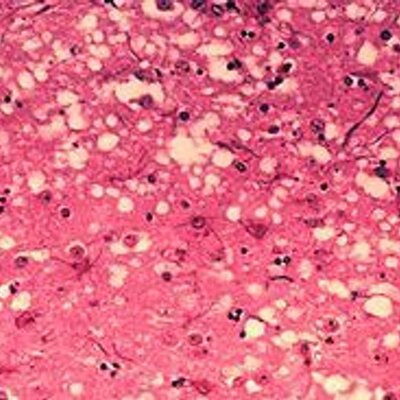 Profile Picture of Andrew Grimshaw (@prionsarebad) on Twitter