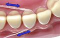 Profile Picture of Dental floss - Wikipediaon Wikipedia