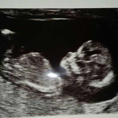 Profile Picture of Becky Simms (@Beck_Simms85) on Twitter