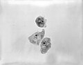 Profile Picture of Naegleria gruberion Wikipedia