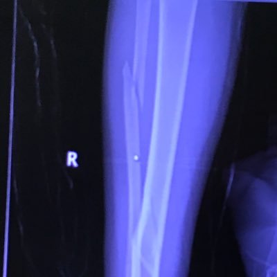 Profile Picture of Jared Lennon (@BreakALegMovies) on Twitter