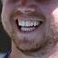 Profile Picture of Justin Smoak's Teeth (@jsmoaks_teeth) on Twitter