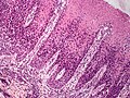 Profile Picture of Pagetoid reticulosison Wikipedia