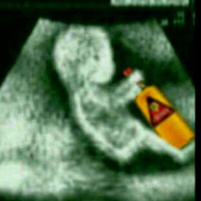 Albert Ramón - Twitter Profile Picture of Albert Ramón (@20_ramn) on Twitter