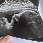 Profile Picture of Mickey Melvin Raymond Kammer (@mickey.mr.kammer) on Instagram