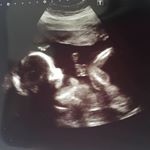 Profile Picture of Janet Swann (@supasec60) on Instagram