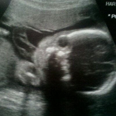 Profile Picture of Haley Reiff (@Grayslyns_mommy) on Twitter