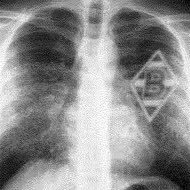 Profile Picture of David Roesler (@DavidRoesler263) on Twitter