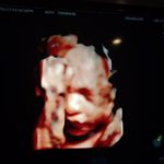 Profile Picture of Gonzalez Jonathan Wason (@francgonzalez850) on Instagram