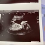 Chrissy Ward - Instagram Profile Picture of Chrissy Ward (@chrissy.t.ward) on Instagram