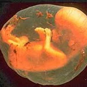 Profile Picture of Fetus Jones (@405238073) on Myspace