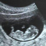 Profile Picture of nathan&samantha (@nathan.samanthan_mcclendon) on Instagram