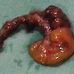 Profile Picture of Adam Dunn's Appendix (@adam.dunnsappendix) on Facebook