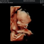 Profile Picture of Alba Sanse (@Alba-Sanse) on Facebook