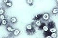 Profile Picture of Betacoronavirus 1on Wikipedia