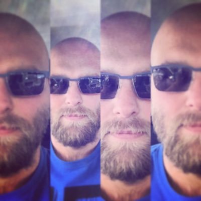 Profile Picture of Carl Dunning (@CarlDunningSBUH) on Twitter