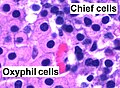 Profile Picture of Parathyroid chief cellon Wikipedia