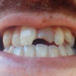 Profile Picture of Jesse (@oh_so_you_wanna_go_skating) on Instagram