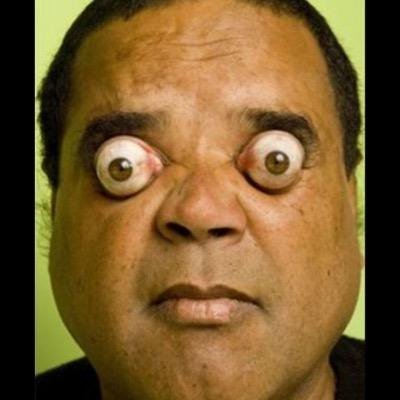 Profile Picture of Allen Jacobson (@datallendoe) on Twitter