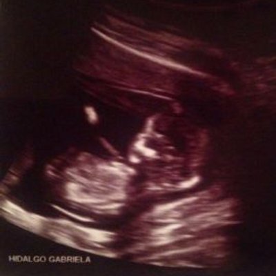 Profile Picture of Michael Gabriel Resa (@ResaGabriel) on Twitter