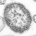 Profile Picture of Measles morbillivirus - Wikipediaon Wikipedia