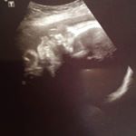 Profile Picture of Casey Joyce (@caseyjoyce64) on Instagram