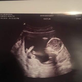 Profile Picture of Coleman McDonald (@coleman.mcdonald.503) on Facebook