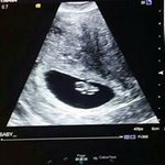 Profile Picture of Carrie O'Reilly (@carrieg1983) on Instagram