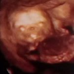 Profile Picture of HiQualityBabyWorm19 (@princejameswormley) on Instagram