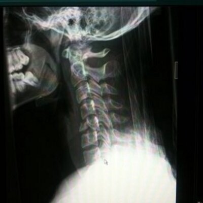 Profile Picture of Tim MacNeil (@XrayTimothy) on Twitter