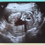 Profile Picture of Ellie Suh (@ellierosesuh) on Instagram