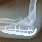 Profile Picture of Joey Parrish (@joeyparrish) on Youtube