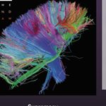 Profile Picture of Ian Brandt (@just.music.here) on Instagram