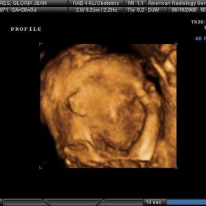 Profile Picture of Jeremiah Rollins (@318054157) on Myspace