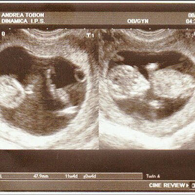 Profile Picture of Andre Sepulveda (@andretsepulveda) on Twitter