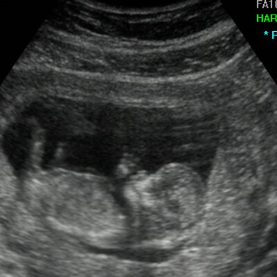 Profile Picture of Jeremy Mosher (@JRome750) on Twitter