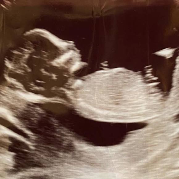 Ernie Alvinito - Poshmark Profile Picture of Ernie Alvinito (@ealvinito) on Poshmark