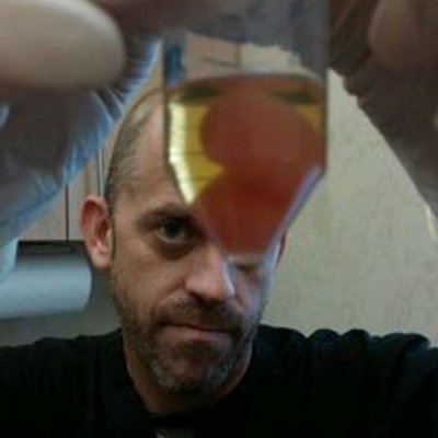 Profile Picture of James Vanden Bosch (@Stemcellboss) on Twitter