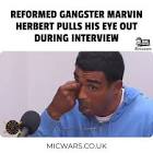 Profile Picture of   Not for the squeamish. Ex... (@micwars) on Tiktok