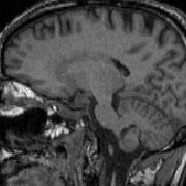 Profile Picture of Brian Stickle (@Brian-Stickle) on Facebook