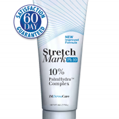 Profile Picture of Stacey Ochoa (@StretchMarkPh10) on Twitter