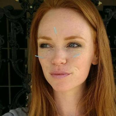 Profile Picture of Christina Bird, LAc. (@CBirdAcu) on Twitter