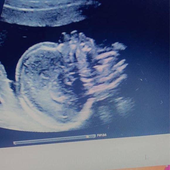 Jerileez Colon - Poshmark Profile Picture of Jerileez Colon (@colonjerileez63) on Poshmark