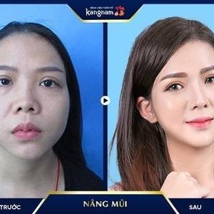 Profile Picture of Nâng Mũi Thẩm Mỹ Kangnam (@nangmuikangnam) on Myspace