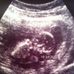 Profile Picture of Ernest Courville (@ernest.courville.5) on Facebook
