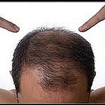 Profile Picture of Adam Watson (@best hair loss clinics) on Flickr