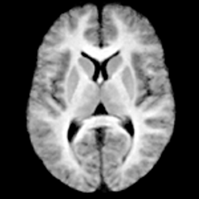 Profile Picture of Craig Bennett (@prefrontal) on Twitter