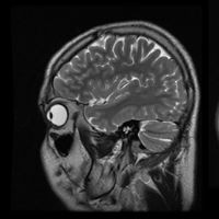 Profile Picture of Adam Gacki (@adam-gacki) on Quora